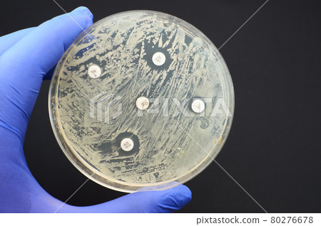 Detecting antimicrobial resistance by Kirby Bauer diffusion test Detecting antimicrobial resistance by Kirby Bauer diffusion test 80276678