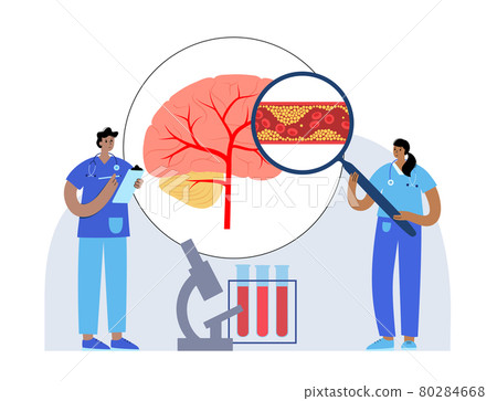 Brain stroke ishemic 80284668