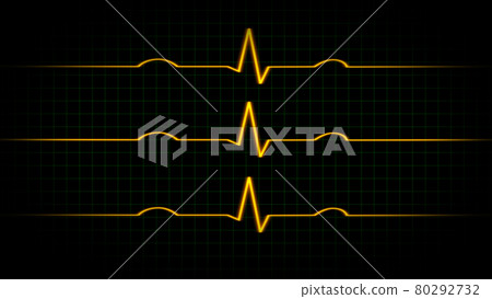 Electrocardiogram oscilloscope waveform CG background wallpaper 80292732