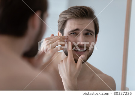 Frustrated handsome millennial guy concerned about facial skin problem Frustrated handsome millennial guy concerned about facial skin problem 80327226