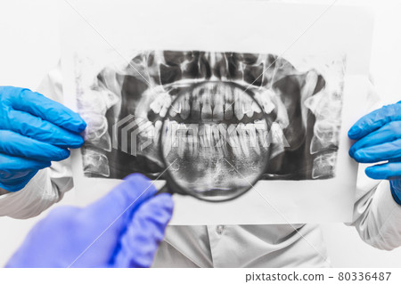 Hands of a man and a woman doctor in protective medical gloves hold and study an x-ray picture of teeth using a magnifying glass Hands of a man and a woman doctor in protective medical gloves hold and study an x-ray picture of teeth using a magnifying glass 80336487