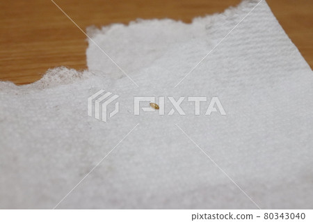 Eggs of flies 80343040