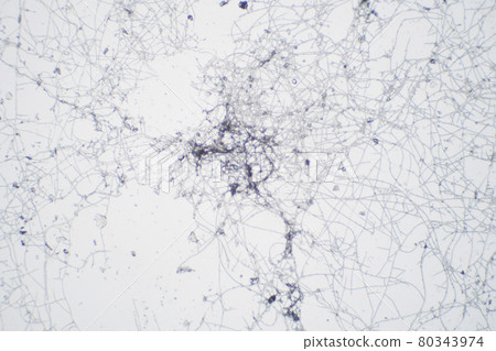 Mold molded with a microscope Mold molded with a microscope 80343974