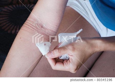 The patient removes the dressing covering the wound from the medical needle puncture on his own 80345196