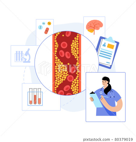 Brain stroke ishemic Brain stroke ishemic 80379019