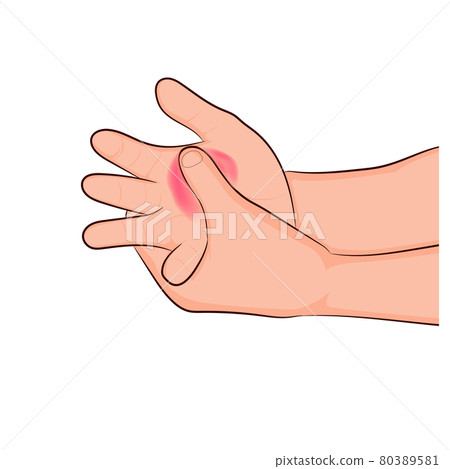 image graphics vector outline Wrist pain is often caused by sprains or fractures from sudden injuries concept health care image graphics vector outline Wrist pain is often caused by sprains or fractures from sudden injuries concept health care 80389581