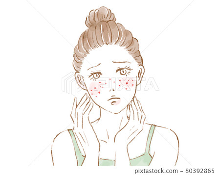Women suffering from acne skin 80392865