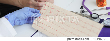 Doctor holds transcript of patient cardiogram in his hands Doctor holds transcript of patient cardiogram in his hands 80396129