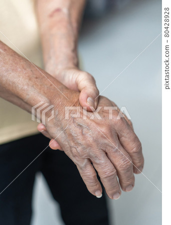 Guillain-Barre Syndrome GBS, Peripheral Neuropathy pain in elderly patient on hand, fingers, sensory nerves with numb, muscle weakness from chronic inflammatory demyelinating polyneuropathy 80428928