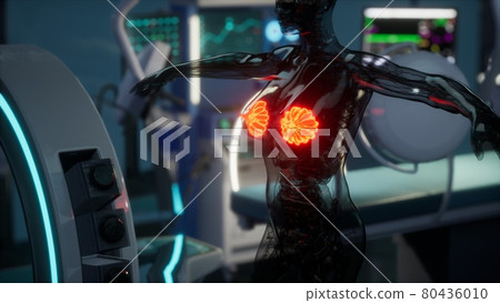 medical scan of Woman Breast medical scan of Woman Breast 80436010
