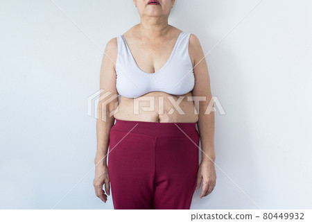 Overweight woman with fat cellulite legs and belly, obesity female