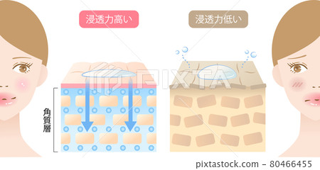 高滲透皮膚和低滲透皮膚女性和橫截面 80466455