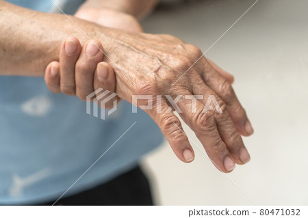 Guillain-Barre Syndrome GBS, Peripheral Neuropathy pain in elderly patient on hand, fingers, sensory nerves with numb, muscle weakness from chronic inflammatory demyelinating polyneuropathy 80471032