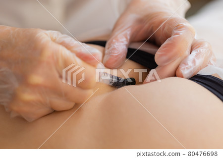 Traditional alternative medicine - doctor doing procedure of hirudotherapy for young woman. 80476698
