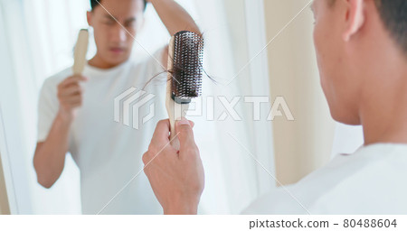 man worry about hair loss man worry about hair loss 80488604