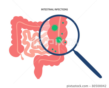 Intestinal infections disease 80500042