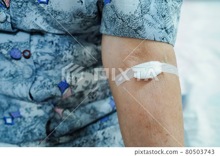 Asian senior or elderly old lady woman patient show cotton wool stop bleeding, after blood drawing testing for annually physical health check up to check cholesterol, blood pressure, and sugar level.. 80503743