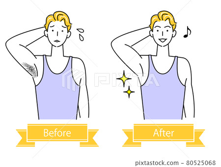 Unwanted hair treatment Before and after illustration of a cute man who removes armpit hair Simple vector Unwanted hair treatment Before and after illustration of a cute man who removes armpit hair Simple vector 80525068