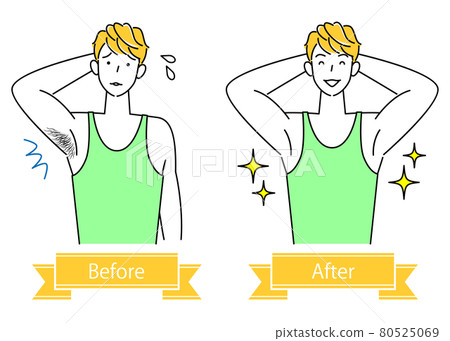 去除腋毛的可愛男人的插圖前後不需要的頭髮處理 簡單矢量 去除腋毛的可愛男人的插圖前後不需要的頭髮處理 簡單矢量 80525069