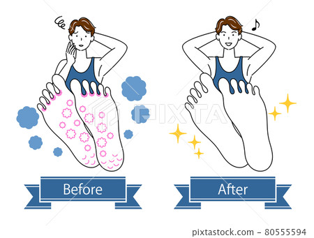 Skin Care Athlete's Foot Before After Skin Trouble on the Sole Cute Male Illustration Simple Vector 80555594