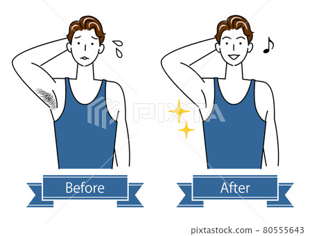 Unwanted hair treatment Before and after illustration of a cute man who removes armpit hair Simple vector 80555643
