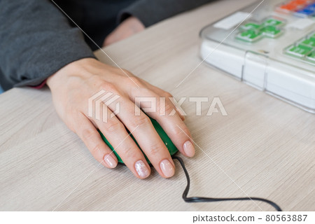 A woman with cerebral palsy uses a specialized orgonomic computer mouse. A woman with cerebral palsy uses a specialized orgonomic computer mouse. 80563887