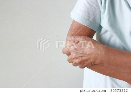 Elbow pain image (senior woman) 80575212