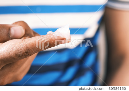 Close up of man hand using petroleum jelly  80584160