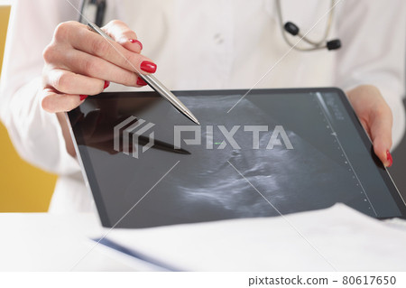 Gynecologist shows ultrasound of baby fetus on tablet Gynecologist shows ultrasound of baby fetus on tablet 80617650