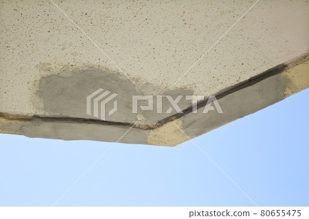 Repair of outer wall Repair of outer wall 80655475