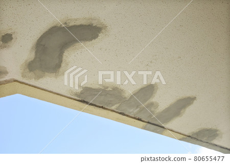 Repair of outer wall 80655477