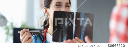 Doctor examines an X-ray of patient hand 80668620