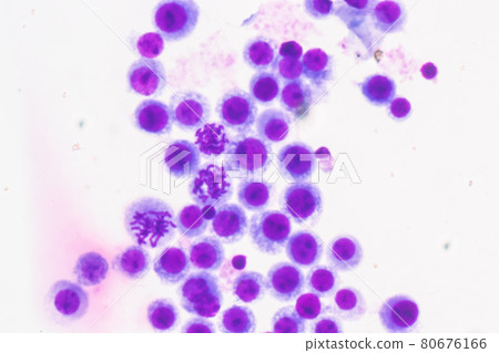 Chromosomes Human under the microscope for education. Chromosomes Human under the microscope for education. 80676166