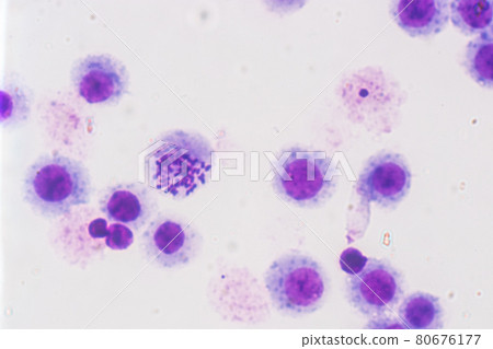 Chromosomes Human under the microscope for education. 80676177