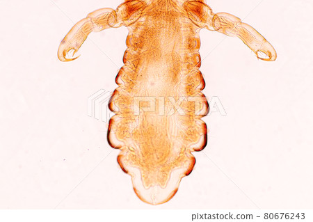 The head louse (Pediculus humanus capitis) is a parasite Live on the body, person or animal and live by sucking blood into food. The head louse (Pediculus humanus capitis) is a parasite Live on the body, person or animal and live by sucking blood into food. 80676243