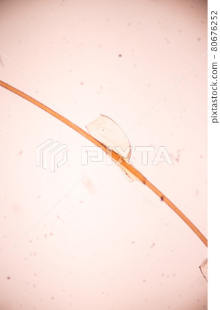 The head louse (Pediculus humanus capitis) is a parasite Live on the body, person or animal and live by sucking blood into food. The head louse (Pediculus humanus capitis) is a parasite Live on the body, person or animal and live by sucking blood into food. 80676252