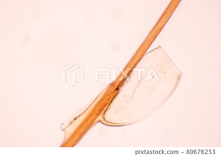 The head louse (Pediculus humanus capitis) is a parasite Live on the body, person or animal and live by sucking blood into food. The head louse (Pediculus humanus capitis) is a parasite Live on the body, person or animal and live by sucking blood into food. 80676253