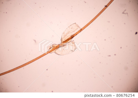 The head louse (Pediculus humanus capitis) is a parasite Live on the body, person or animal and live by sucking blood into food. The head louse (Pediculus humanus capitis) is a parasite Live on the body, person or animal and live by sucking blood into food. 80676254
