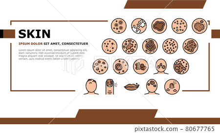 Skin Disease Symptom Landing Header Vector Skin Disease Symptom Landing Header Vector 80677765