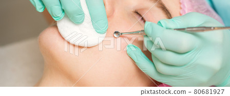 The beautician removes blackhead and acne on the female face in a beauty salon, blackhead removal tool. 80681927