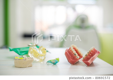 Orthodontic teeth models dental education model jaws with half ceramic and half metal bracket Teeth and Jaw Models. Orthodontic teeth models dental education model jaws with half ceramic and half metal bracket Teeth and Jaw Models. 80691572