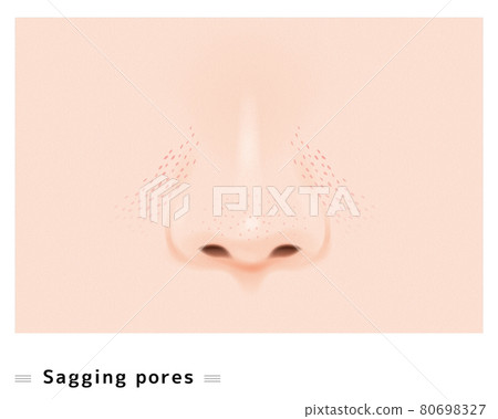 Nose Nostrils Pore Care Cosmetology Treatment Skin Care Dropped Drooping Illustration 80698327