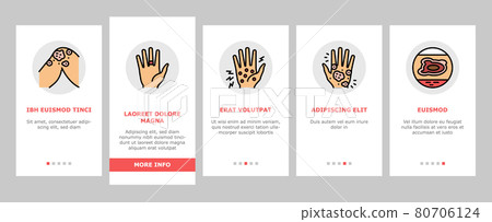 Eczema Disease Treat Onboarding Icons Set Vector Eczema Disease Treat Onboarding Icons Set Vector 80706124