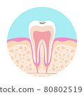 Illustration of a dentist A picture of dental caries 80802519