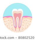 Illustration of a dentist A picture of dental caries 80802520