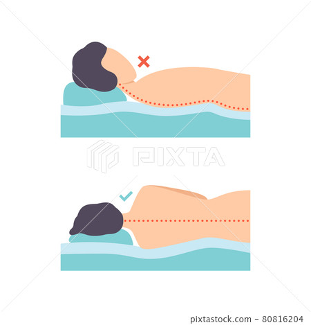 Man Lying in Correct and Incorrect Sleeping Pose for Neck and Spine Vector Set Man Lying in Correct and Incorrect Sleeping Pose for Neck and Spine Vector Set 80816204