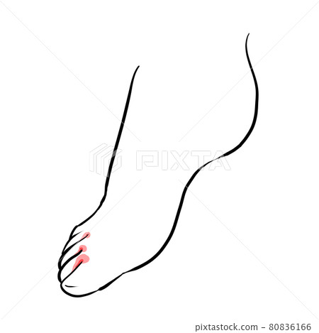 運動員的腳腳圖 80836166