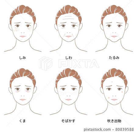套婦女,秀麗,皮膚問題,老化,皮膚問題 套婦女,秀麗,皮膚問題,老化,皮膚問題 80839588