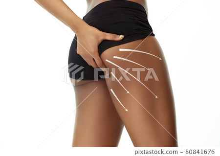 Close-up beautiful female body with lifting up arrows isolated on white background. Collage. Resilient skin, fitness body, anti cellulite procedures. Close-up beautiful female body with lifting up arrows isolated on white background. Collage. Resilient skin, fitness body, anti cellulite procedures. 80841676