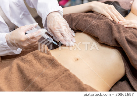 接受整容手術的女性（溶脂注射、腹部） 80861697